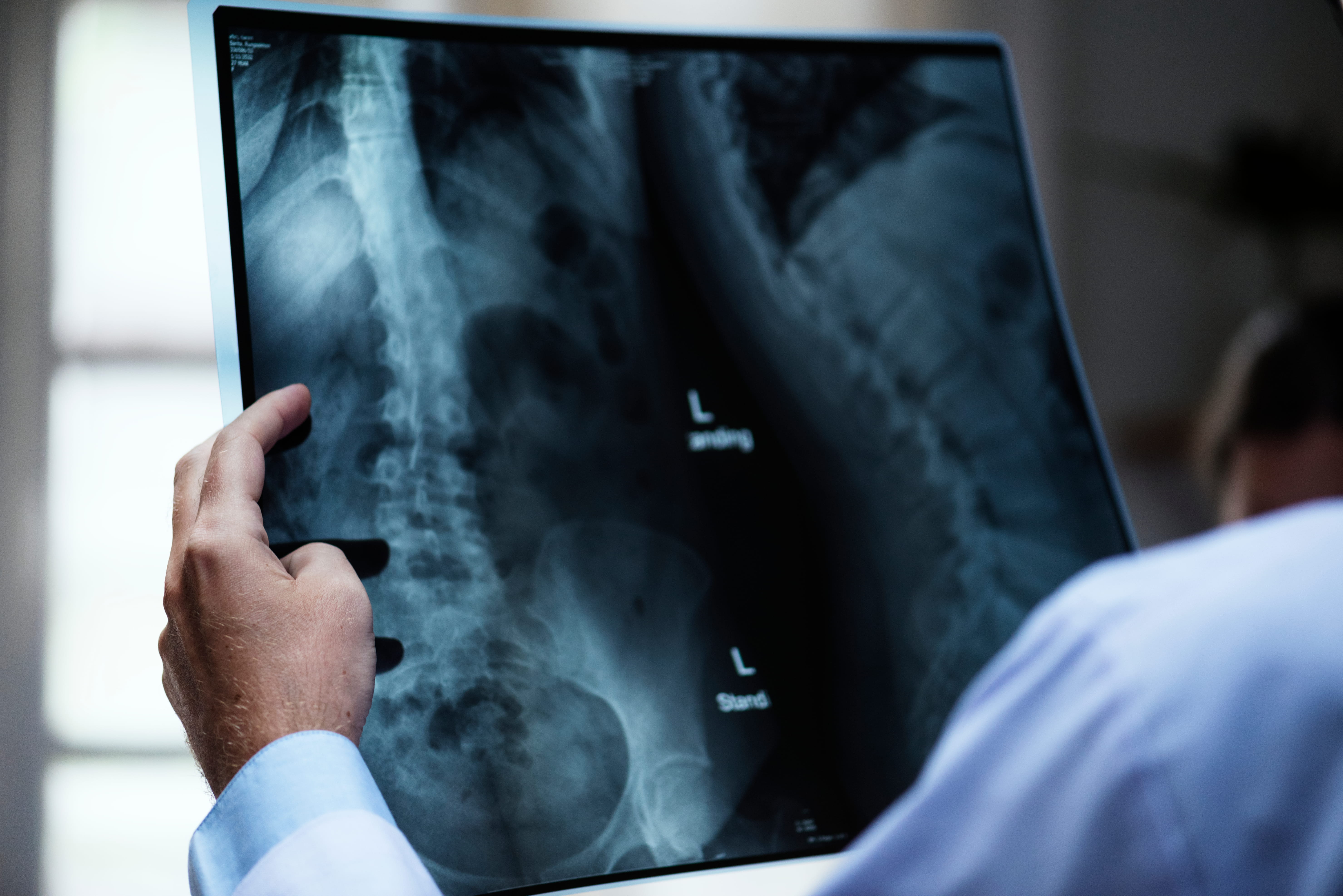 médico com raio X de paciente